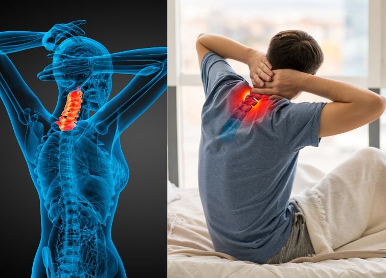 cervical spondylitis in india